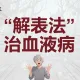 解表法